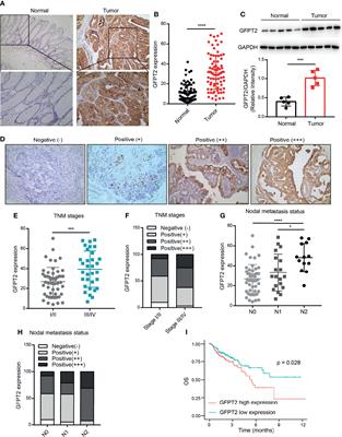 Roles of GFPT2 Expression Levels on the Prognosis and Tumor Microenvironment of Colon Cancer